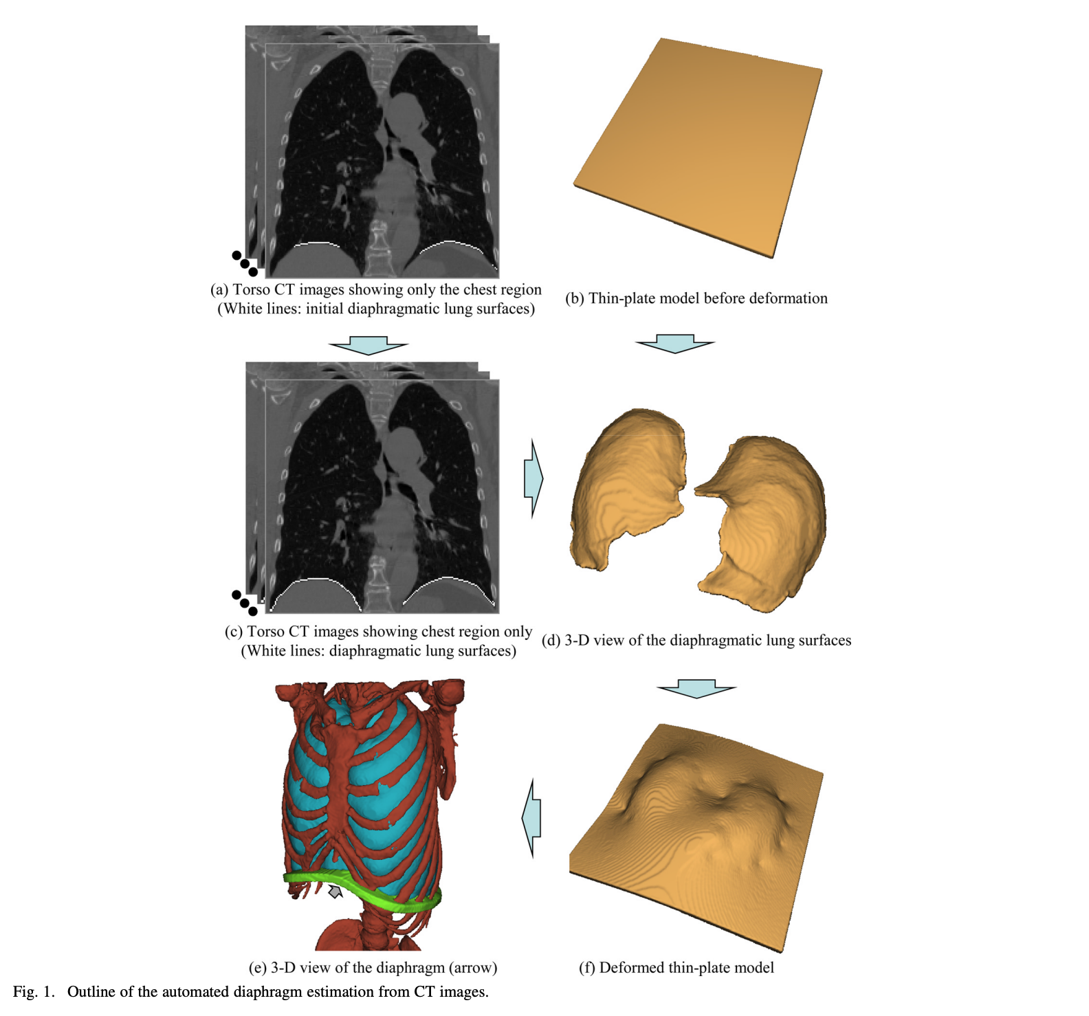 Diaphragm Segmentation in CT Images: A Review of Mathematical and Computational Methods