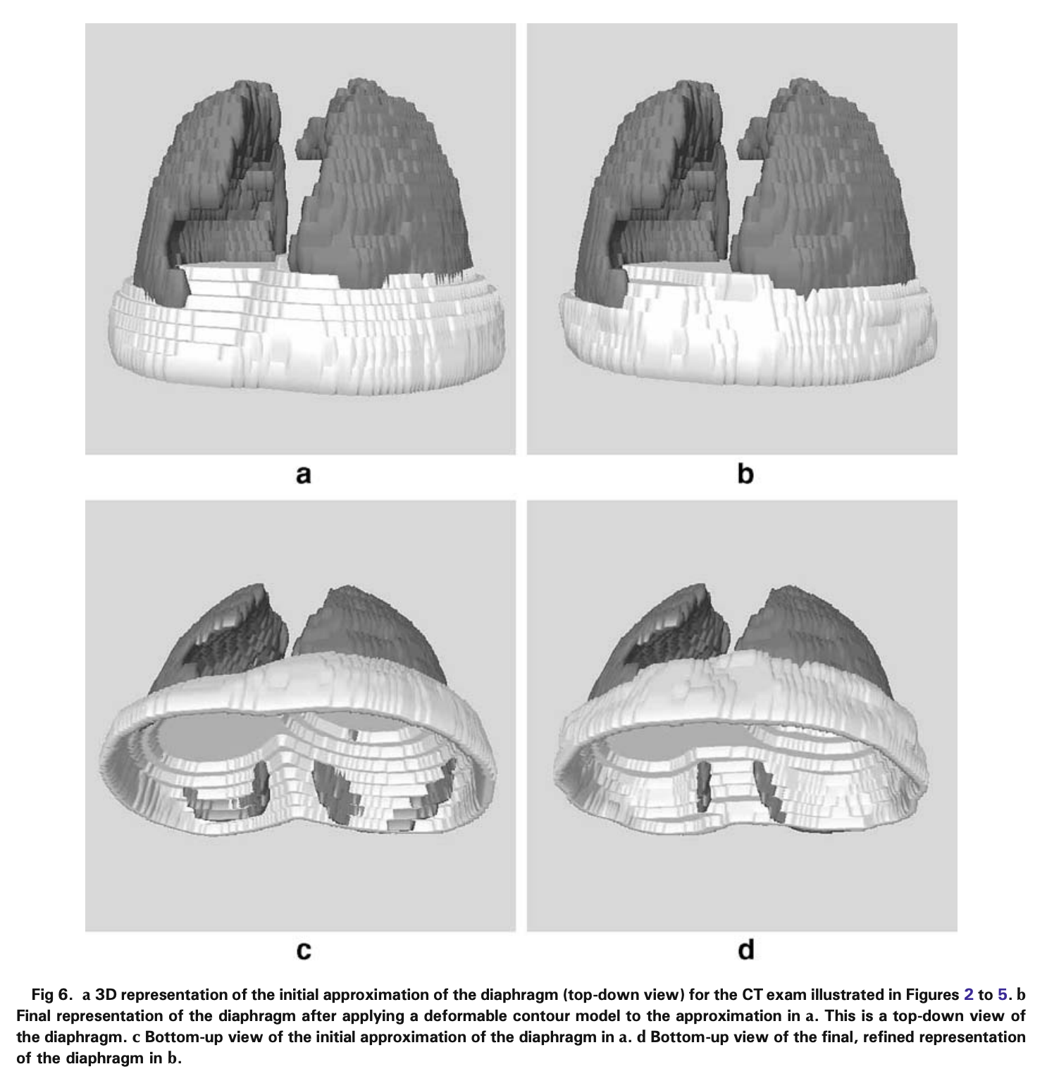 Diaphragm Segmentation in CT Images: A Review of Mathematical and Computational Methods