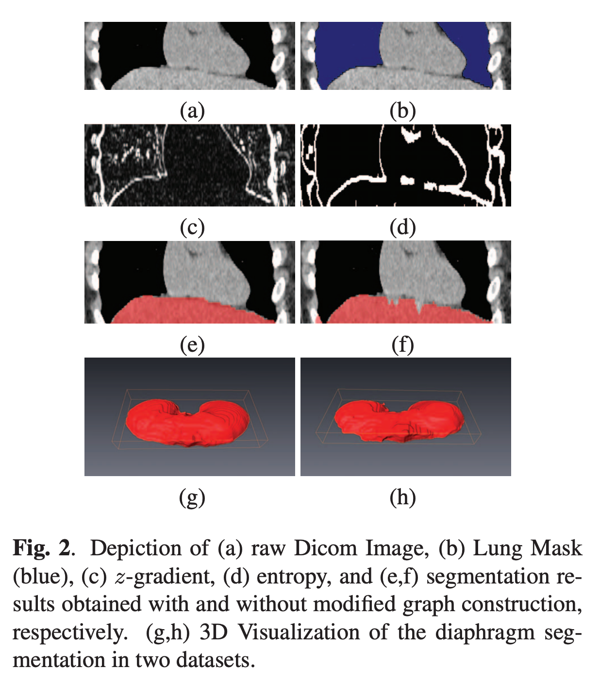 Diaphragm Segmentation in CT Images: A Review of Mathematical and Computational Methods