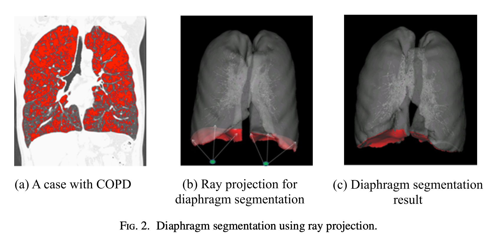 Diaphragm Segmentation in CT Images: A Review of Mathematical and Computational Methods