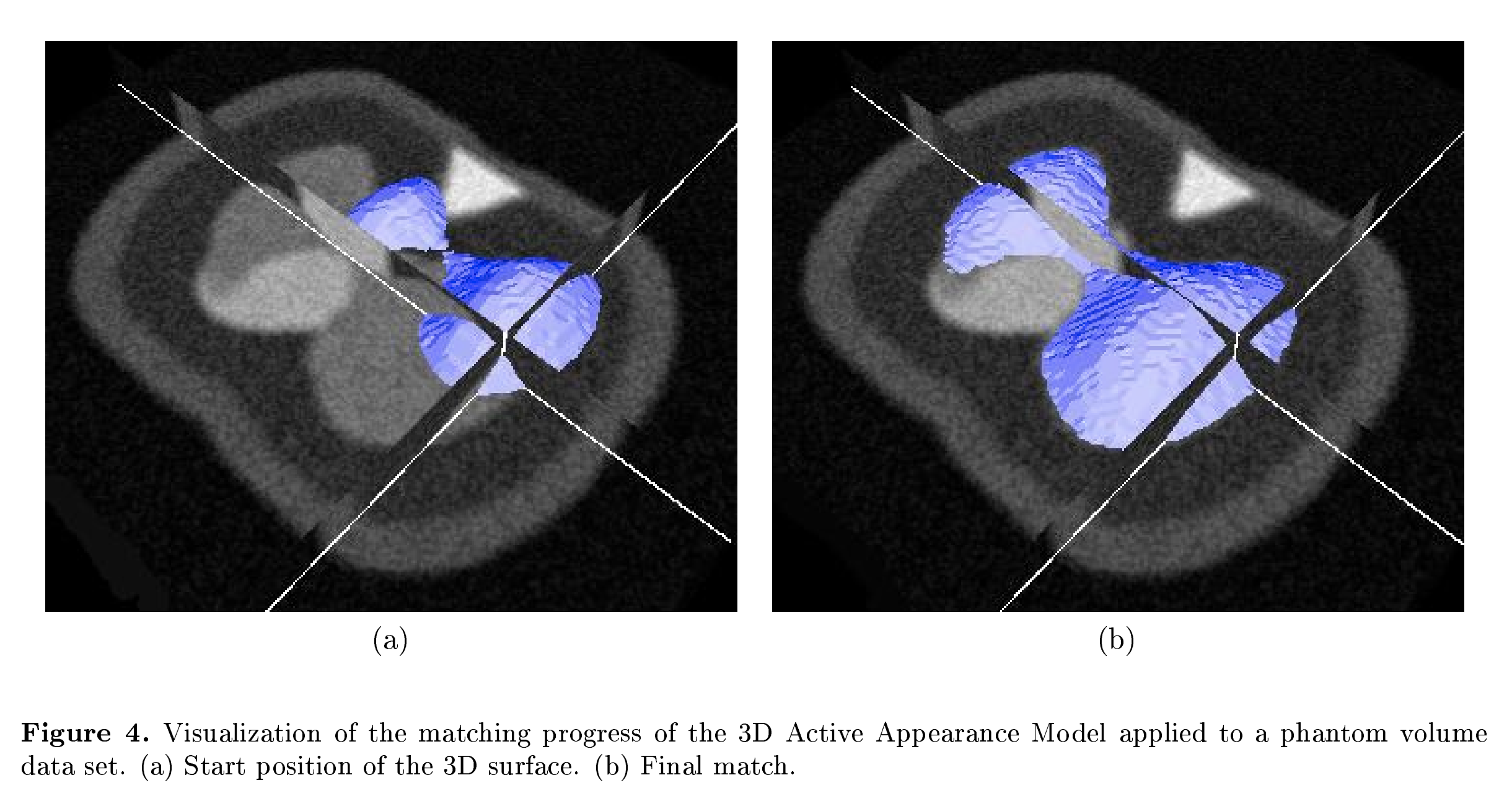 Diaphragm Segmentation in CT Images: A Review of Mathematical and Computational Methods