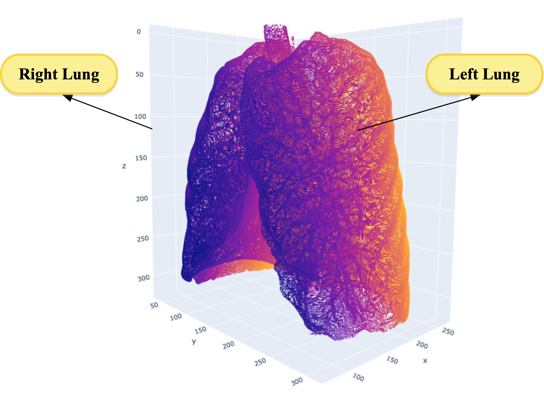 Diaphragm Function Evaluation in COPD Patients Using Chest CT Image Analysis