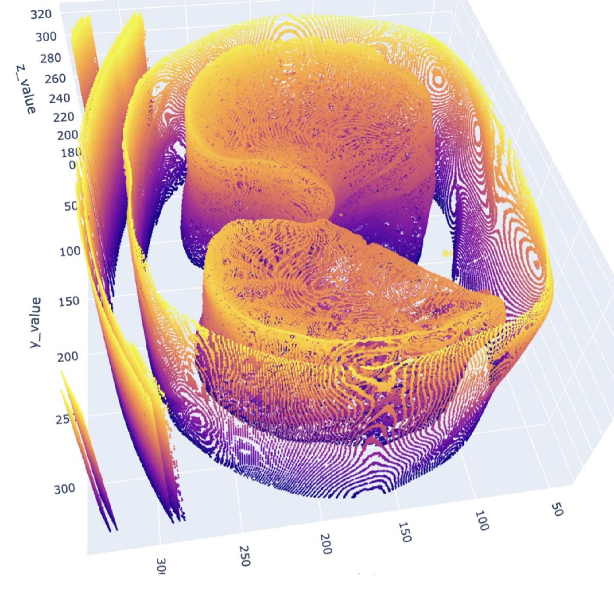 Diaphragm Function Evaluation in COPD Patients Using Chest CT Image Analysis