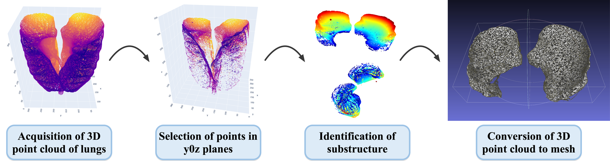 Diaphragm Function Evaluation in COPD Patients Using Chest CT Image Analysis