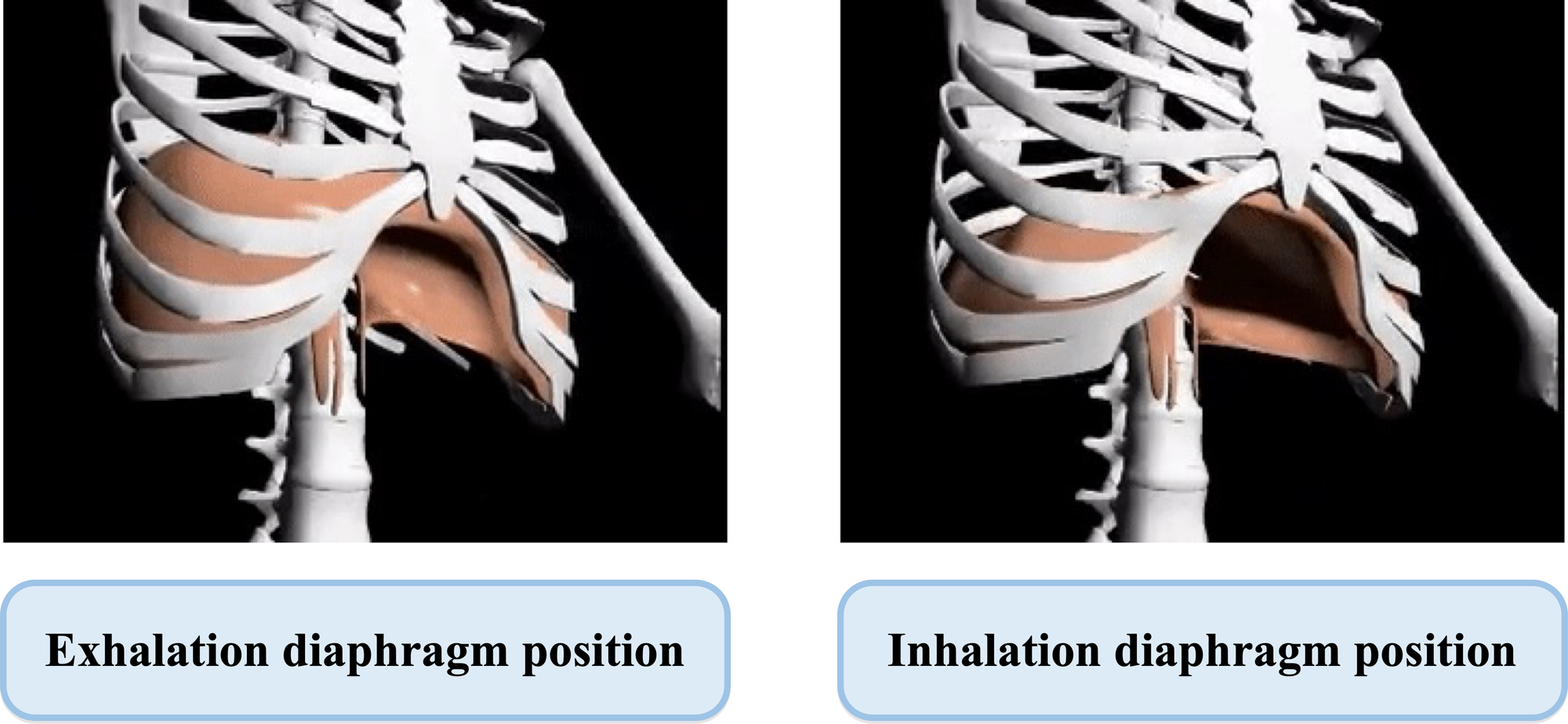 Diaphragm Function Evaluation in COPD Patients Using Chest CT Image Analysis